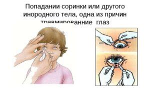 Соринка в глазу какие капли использовать. Что делать, если в глаз ...