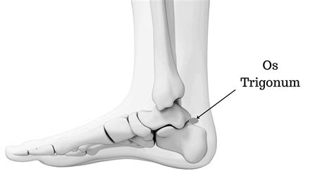 Os Trigonum | Back of Ankle Pain Explained by a Foot Specialist