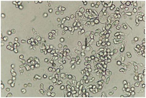 Trichomonas Vaginalis Microscope