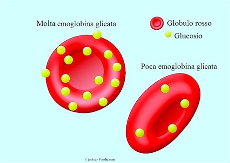 Emoglobina Alta Nel Sangue E Nelle Urine Glicata Valori