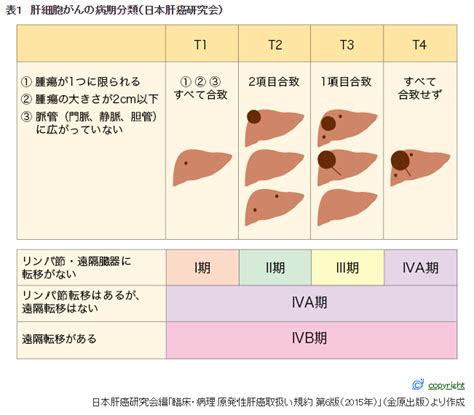 肝臓がん がんセンター