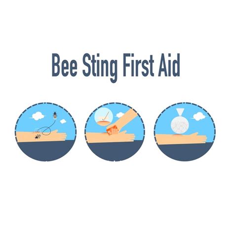 96 Bee Sting First Aid Royalty Free Images Stock Photos And Pictures