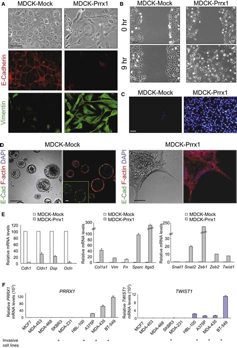 Metastatic Colonization Requires The Repression Of The Epithelial Mesenchymal Transition Inducer