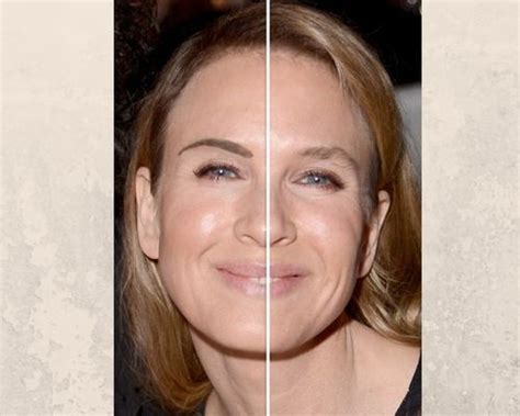 Renee Zellweger Plastic Surgery Secrets Complete Guide Fabbon