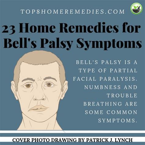 Learn How To Treat The Symptoms Of Bells Palsy By Using All Natural Home Remedies Bellspalsy