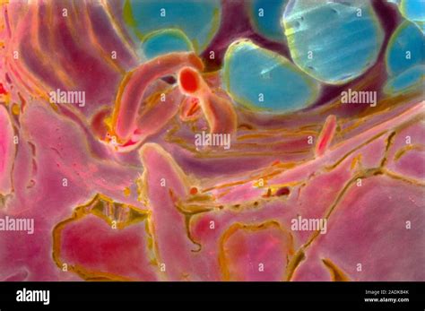 Megakaryocytes Coloured Scanning Electron Micrograph Sem Of