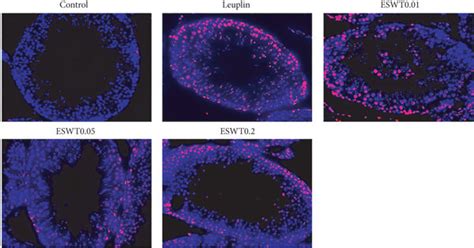 Tunel Assay To Detect The Effect Of Li Eswt On Apoptosis Of Testicular