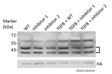 Anti P Mapk Phospho Thr Tyr Antibody Gtx Genetex