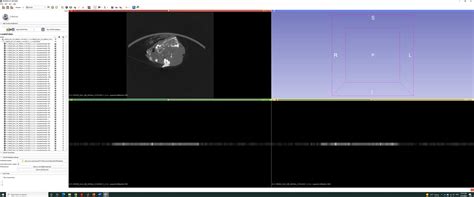 Merging Different Dicom Files Together Support 3d Slicer Community