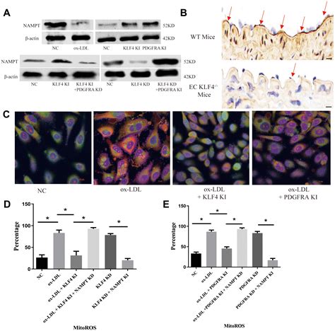 Klf4 Inhibited The Senescence Associated Secretory Phenotype In Ox Ldl