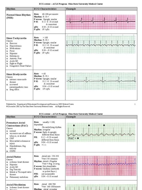 EKG Examples Of Interpretation Cardiac Nursing Icu Nursing Ekg