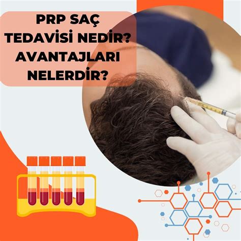 Prp Sa Tedavisi Nedir Ve Avantajlar Nelerdir Sa Ekimi Bilgi