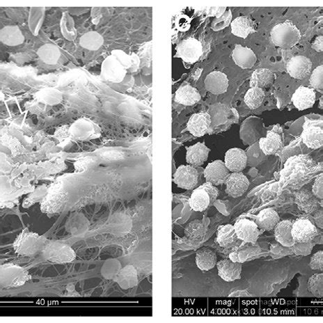 Arrows indicate Staphylococcus epidermidis biofilm on the washers ...