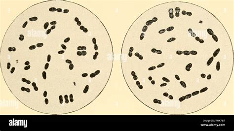 Streptococcus Pneumoniae Under Microscope