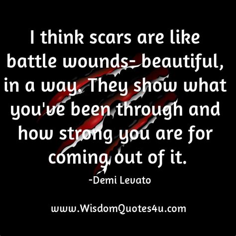 Scars Make Us Beautiful Quotes. QuotesGram