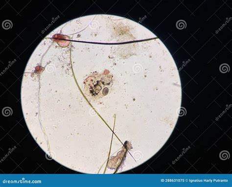 Scabies, Notoedres Egg Under The Microscope Stock Image | CartoonDealer ...