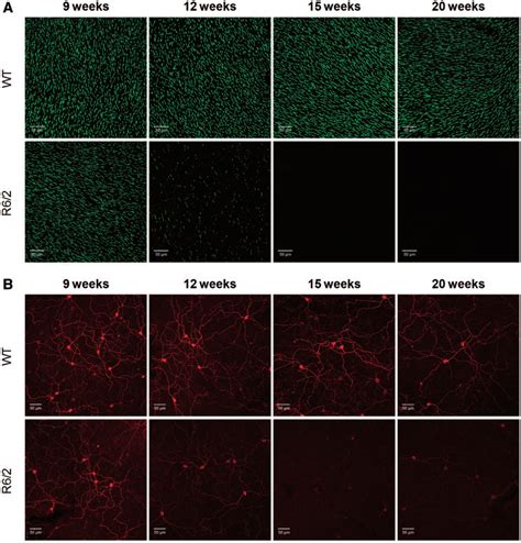 Time Course Of Cone Opsin And Melanopsin Expression In R Mice A