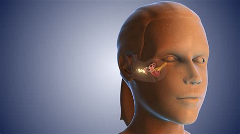 Ear Wax Infection Medical Concept Stock Photo - Download Image Now ...