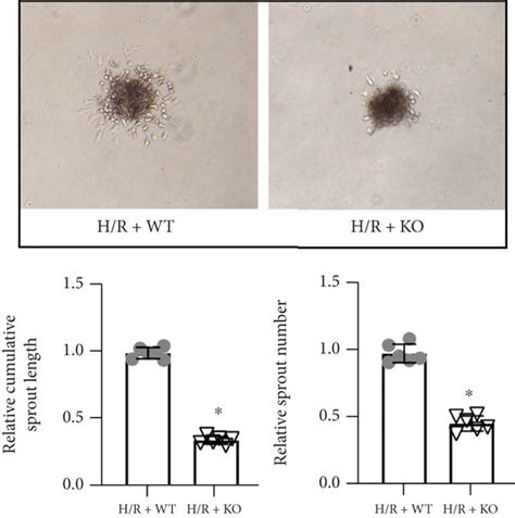 KDM3A Knockout Exaggerated H R Induced CMEC Injury And Dysfunction A