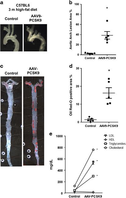 Accelerated Atherosclerosis Development In C57bl6 Mice By