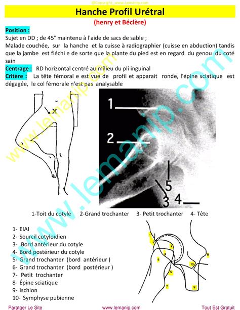 Incidences Radiologiques Du Bassin Et L Hanche Coxom Trie