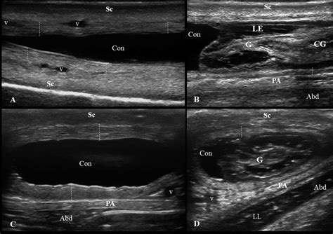 Ultrassonografia Em Planos Dorsal A Longitudinal B E Transversal