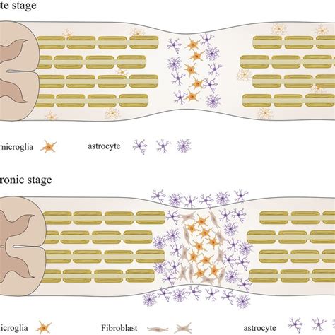 The stages of glial scars after spinal cord injury. Schematic drawings ...