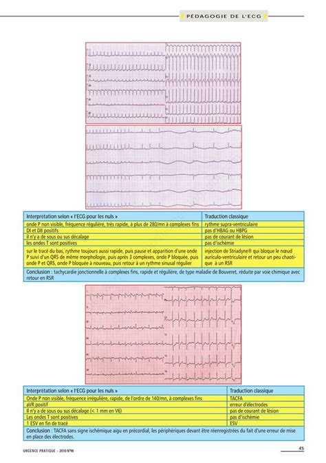 L ecg pour les nuls pédagogie de l ecg PDF