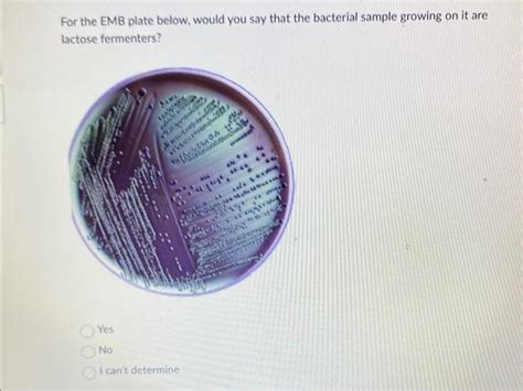 Solved Look at the MSA plate result below and answer: is the | Chegg.com