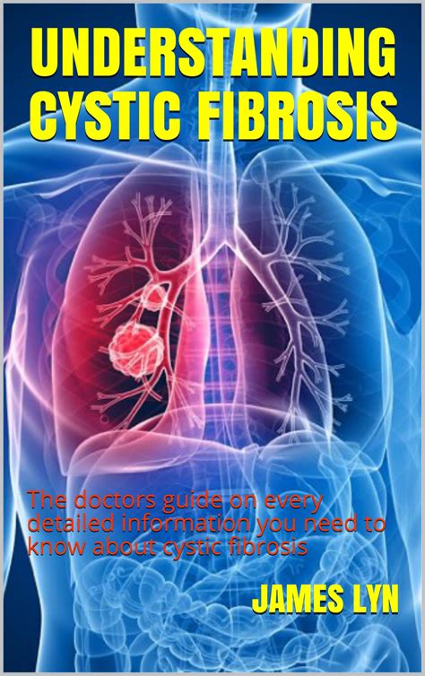 Buy Understanding Cystic Fibrosis The Doctors Guide On Every Detailed