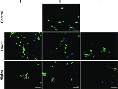 Representative Fluorescence Micrographs Showing Ng108 Cells After 48 H