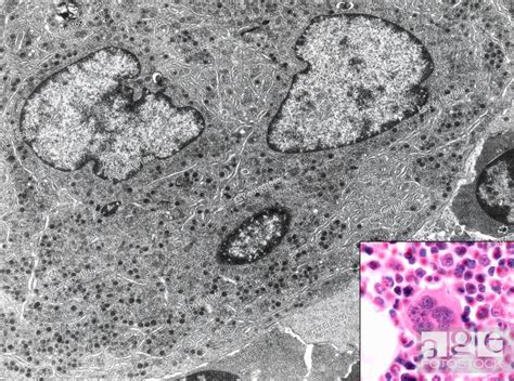 The Megakaryocyte Is A Giant Bone Marrow Cell With A Very Large