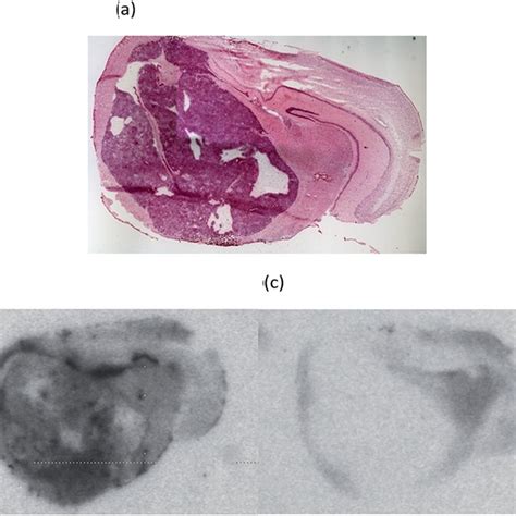 Representative Immunohistochemistry Images Of A Cd Nude Mouse Brain