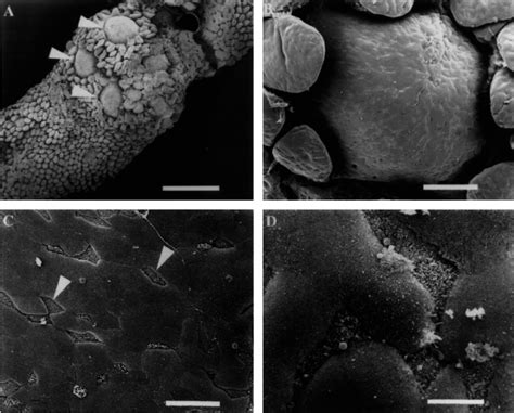 Scanning Electron Micrographs Of Murine Peyers Patch Tissue A