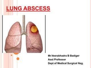 Lung abscess & Nursing care | PPT