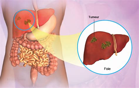 Health Condition Symptoms Causes Treatment And More