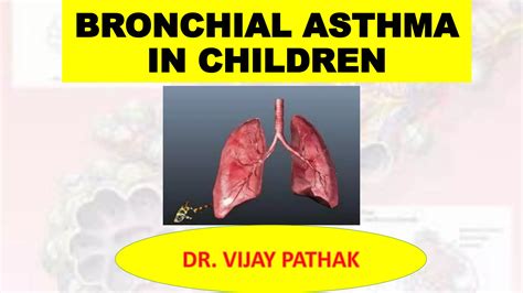 Bronchial Asthma Ppt