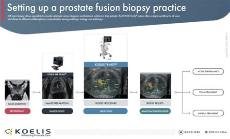 Setting up a prostate fusion biopsy practice | KOELIS Academy