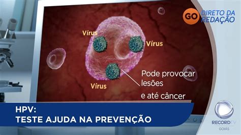 HPV TESTE AJUDA NA PREVENÇÃO YouTube