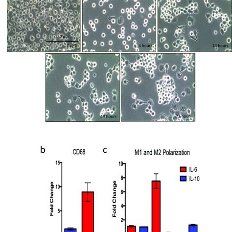 Monocyte To Macrophage Differentiation And Polarization Sc Monocytes