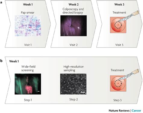 Current And Future Cervical Screening Techniques A Currently