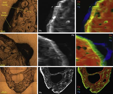 Synchrotron Mxrf Compositional Maps Of Rib Section From Ferrante Ii Download Scientific