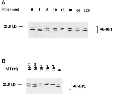 Aii Stimulates Phosphorylation Of E Bp In Aortic Smc Rat Aortic Smc