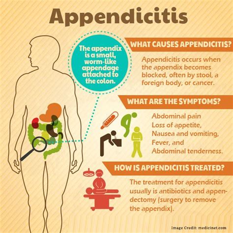 All About Appendicitis Early Signs Symptoms Causes Treatment