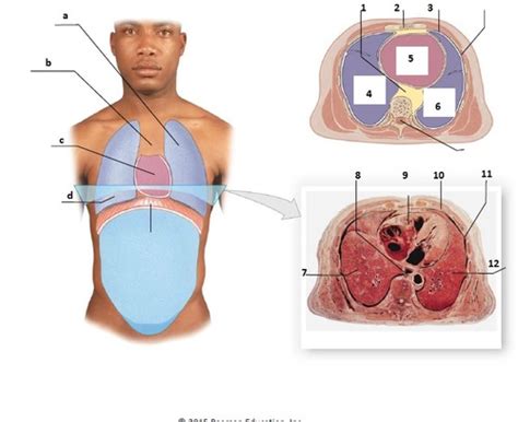 Pulmonology Anatomy Lab Flashcards Quizlet