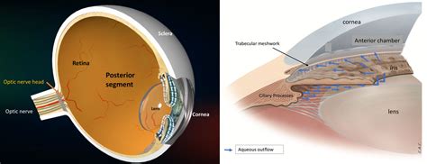 What Is Open Angle Glaucoma