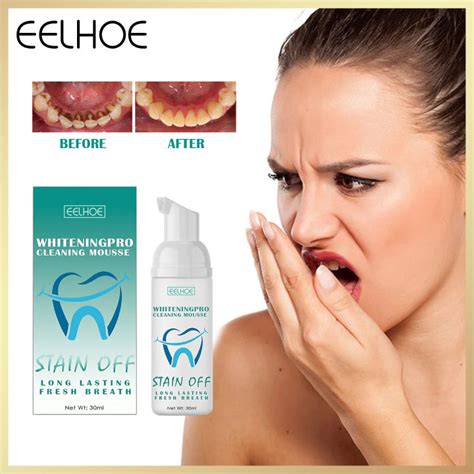 Eelhoe Tooth Brightening And Cleaning Mousse Fresh Breath Tooth Stain