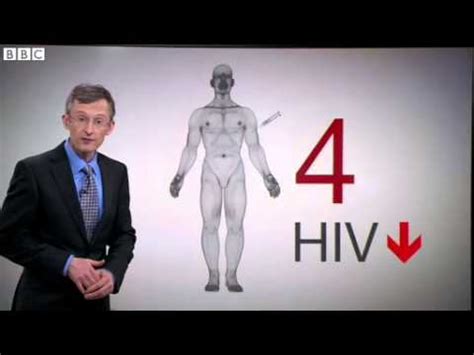 Bbc News Hiv Gene Therapy Breakthrough Patients On Medication Youtube