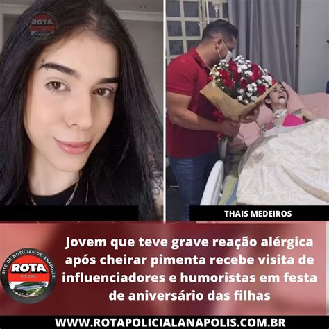 Jovem Que Teve Grave Rea O Al Rgica Ap S Cheirar Pimenta Recebe Visita