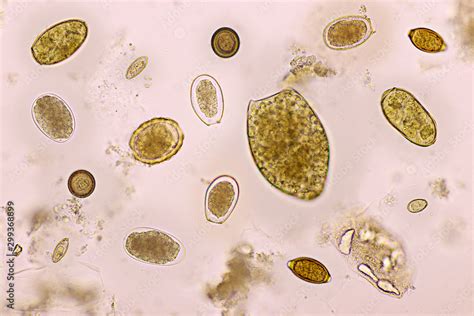 Parasites In Stool Microscope